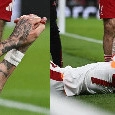 Lang choc, ha rischiato l'amputazione del dito! Operato d'urgenza, l'UEFA ha avviato un'indagine: come sta