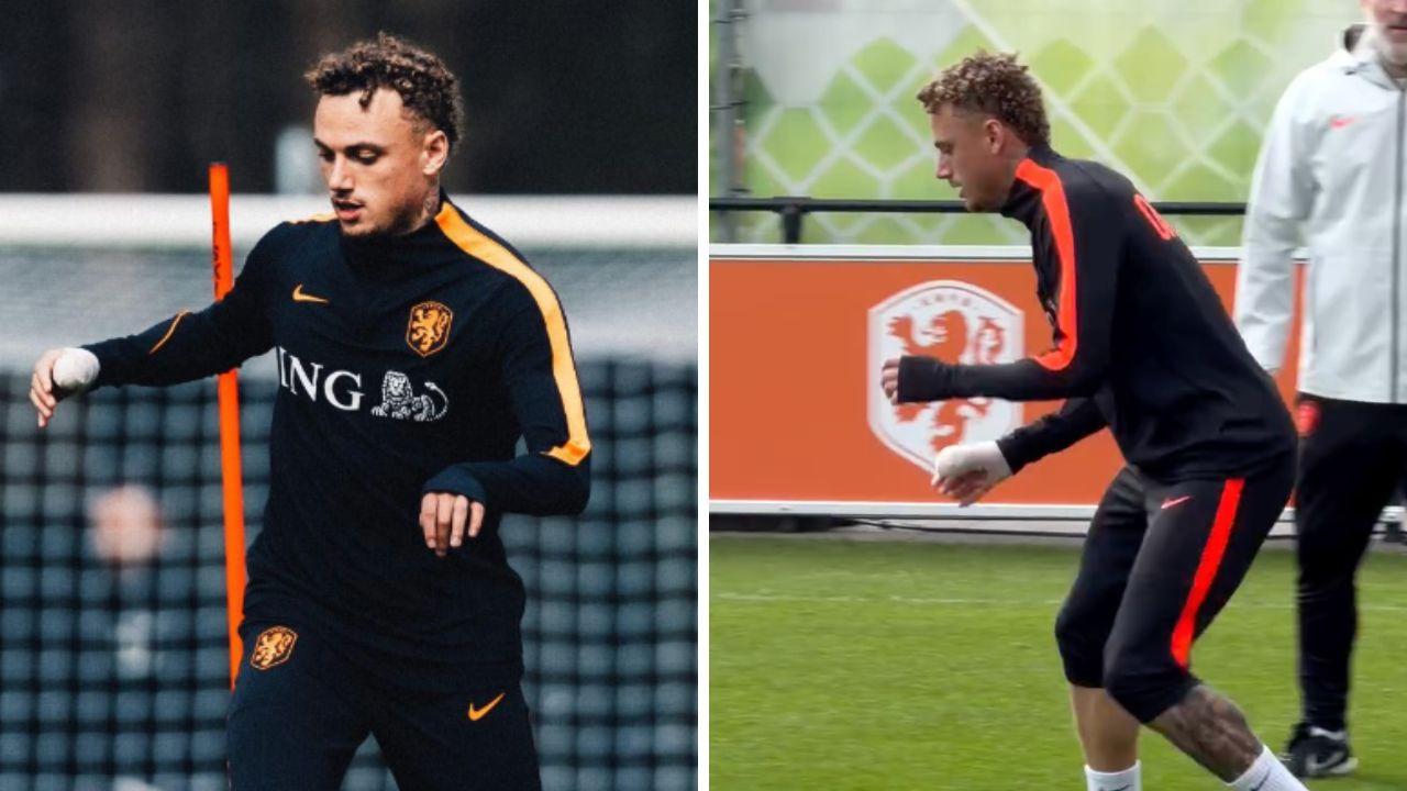 Noa Lang col dito fasciato dopo l'infortunio shock: "Il pollice &egrave; ancora attaccato, le operazioni sono andate bene" | VIDEO