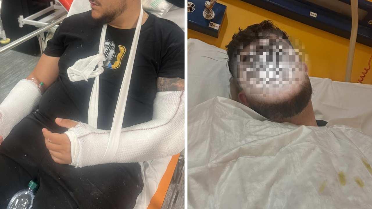 Tifoso del Napoli ferito allo stadio Tardini di Parma: "Ecco che cosa mi &egrave; successo"