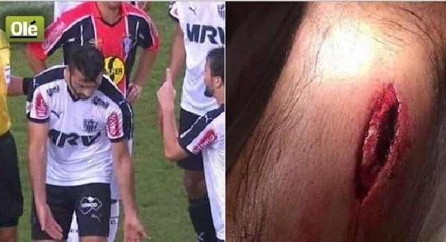 FOTO & VIDEO - Grave infortunio per Datolo: profonda ferita sul polpaccio! Ecco le immagini
