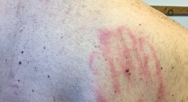 FOTO - Starace e il gioco con Tonelli: Guardate il nuovo tatuaggio...