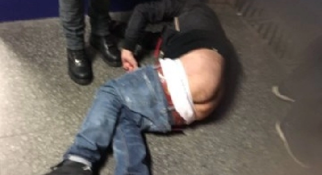 FOTO E VIDEO - Violenze ad Istanbul, tifoso del Napoli pestato a sangue
