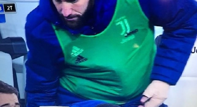 Juve, infortunio al dito per Higuain: in panchina col tutore, i dettagli [VIDEO]