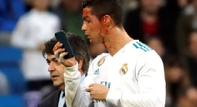 Sangue in faccia dopo uno scontro, Ronaldo chiede un cellulare per controllare i danni [FOTO]