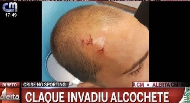 Dal Portogallo - Aggressione ai calciatori, arriva la decisione dello Sporting Lisbona per tutelare i giocatori: aumentata la sicurezza per stadio e centro d'allenament