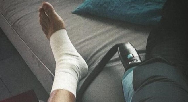 Dybala mostra la caviglia fasciata dopo l'intervento di Mario Rui [FOTO]
