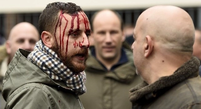 Tifoso del Liverpool in ospedale: aggredito senza motivo da ultras napoletani in pieno centro