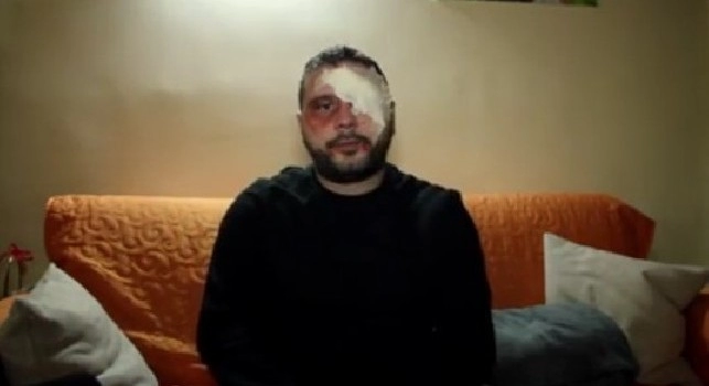 100 scuse per vedere il Napoli a San Valentino, esilarante sketch de 'Gli Scusateci' [VIDEO]