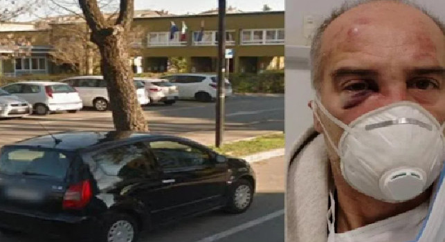 Coronavirus, clamoroso a Padova: podista corre senza mascherina e viene picchiato a sangue da un padre e un figlio