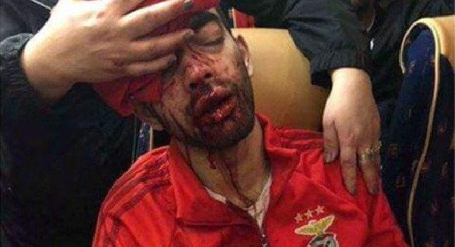 Choc in Portogallo, sassaiola contro il bus del Benfica: 2 giocatori finiscono all'ospedale