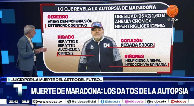 Morte Maradona, l'autopsia rivela uno spaventoso quadro clinico | FOTO