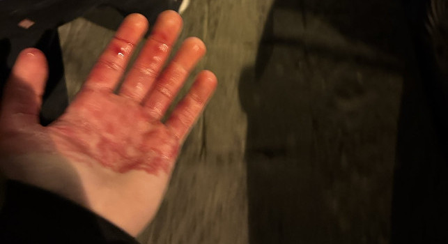 Due tifosi inglesi feriti stasera a Napoli: il comunicato del Chelsea