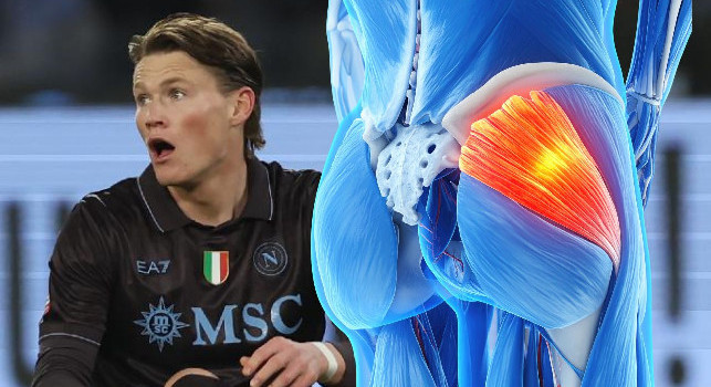 McTominay ha un'infiammazione al gluteo! Ecco quando potr&agrave; giocare di nuovo