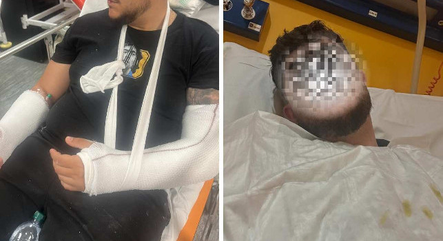 Tifoso del Napoli ferito a Parma