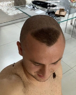 #ronaldochallenge, Lobotka accetta la sfida: questo il risultato [FOTO]