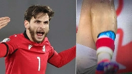 Turchia-Georgia, Kvaratskhelia in campo col parastinchi del Napoli | FOTO
